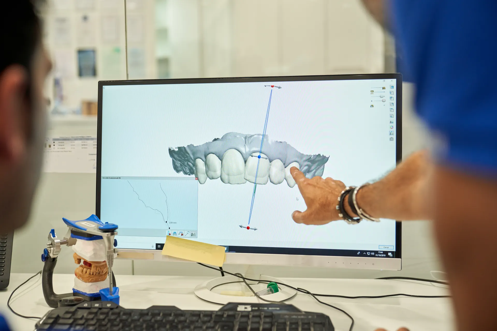 Patientenberatung mit digitalem Smile Design